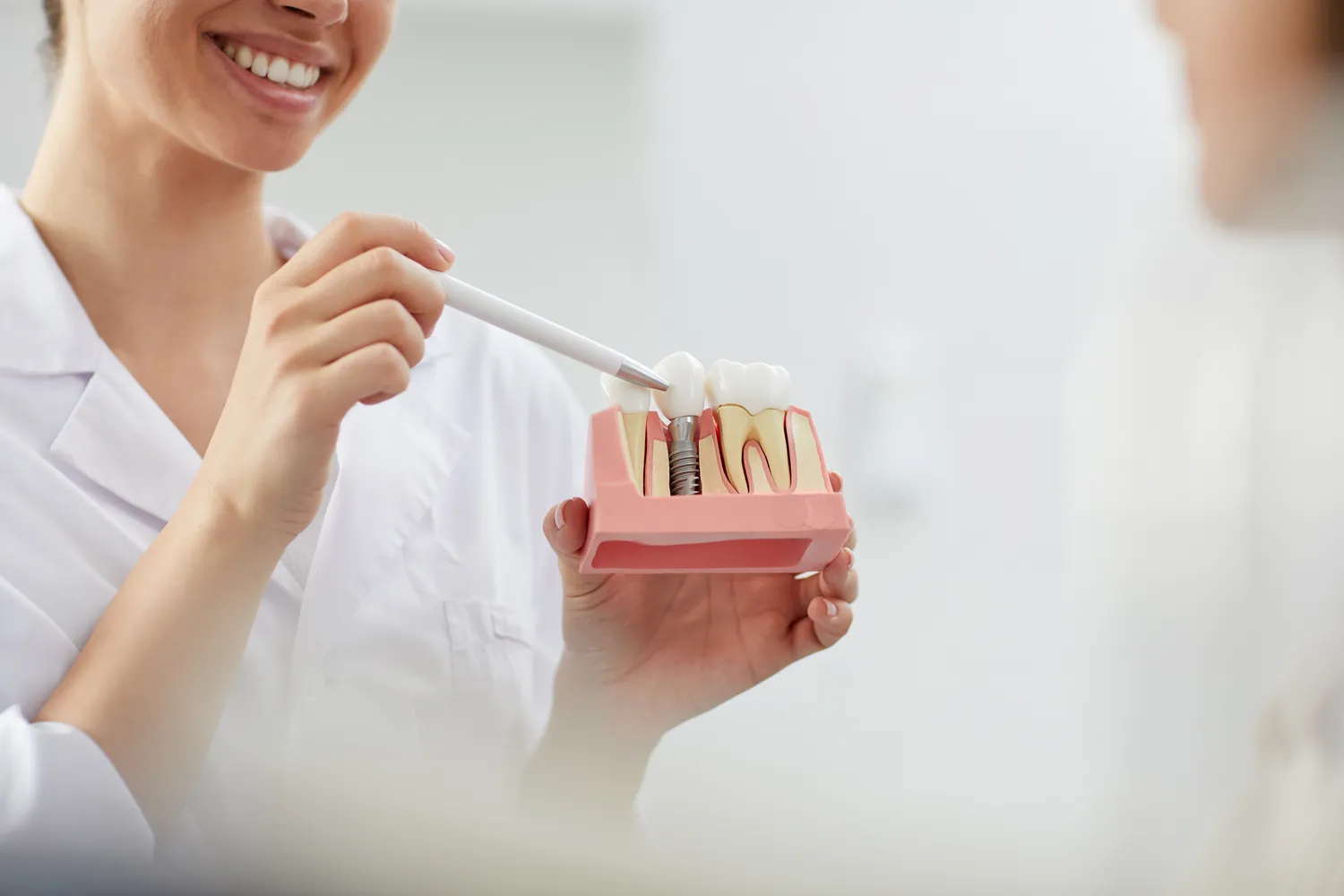 Implanty dentystyczne Warszawa