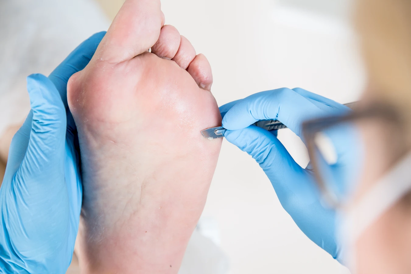  Pedicure leczniczy - co o nim wiedzieć warto?